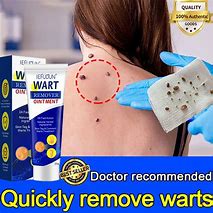 Image result for warts remove creams for children