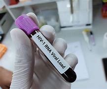 Image result for Aids Blood