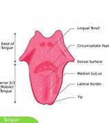 Image result for Papilloma On Tongue
