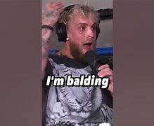 Image result for Jake Paul Balding