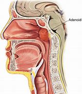 Image result for adenoidwo