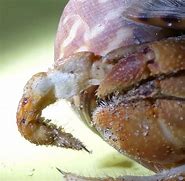 Image result for What Are Crabs Disease