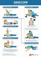 Image result for Easy CPR Compressions