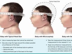 Image result for Head Circumference Measurement