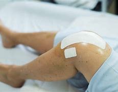 Image result for Knee Surgery Recovery