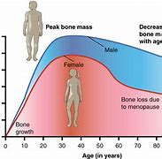 Image result for Normal Bone Density Chart