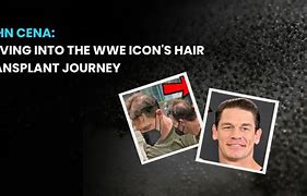 Image result for John Cena Hair Plugs