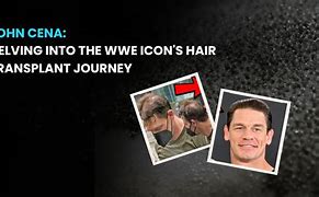 Image result for John Cena Today Hair Loss