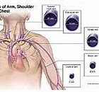 Image result for Hand and Arm Veins