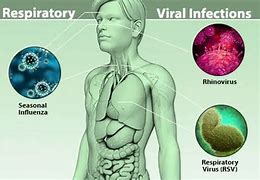 Image result for Viral Upper Respiratory Tract Infection