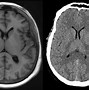 Image result for Brain Neuron Scan