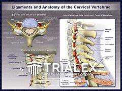 Image result for Human Cervical Vertebrae