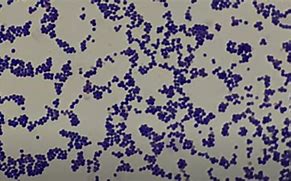 Image result for Gram Stain Positive Cocci