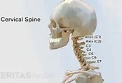 Image result for Cervical Spine C4 C5