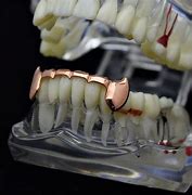 Image result for Rose Gold Grillz Teeth