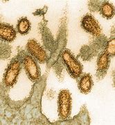 Image result for Spanish Flu Microscope