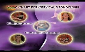 Image result for Cervix Dilation Chart