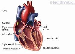 Image result for Heart Murmur Surgery
