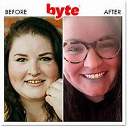 Image result for Byte Before and After Pics