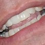 Image result for John Cena Teeth