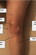 Image result for Knee Vins Sharp Pain