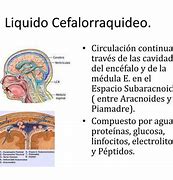 Image result for cefalorraqh�deo
