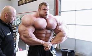 Image result for World's Biggest Muscles