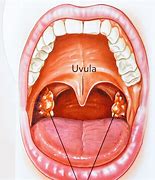 Image result for Chlamydia Throat Infection