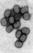 Image result for Molluscam Contagiosum Virus