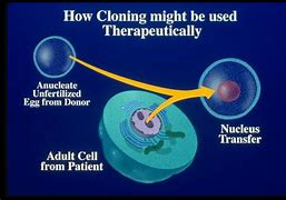 Image result for Therapeutic Cloning Stem Cells