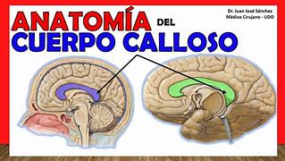 Image result for calloso