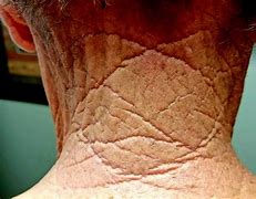 Image result for cutis