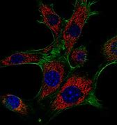 Image result for actin�metto