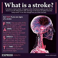 Image result for Brain Attack Symptoms