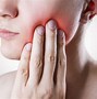 Image result for Oral Cancer HPV