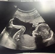Image result for Ultrasound Side Profile