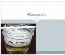 Image result for albuminutia