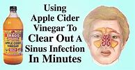 Image result for Sinusitis Apple Cider Vinegar