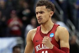 Image result for Trae Young Bald Spot