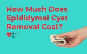 Image result for Epididymal Cyst Size Chart