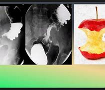 Image result for Apple Core Sign