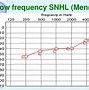 Image result for Acoustic Reflex