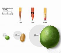Image result for Dimension Inches to mm
