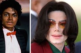 Image result for MJ Before and After Plastic Surgery