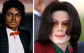 Image result for Michael Jackson Nose
