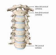 Image result for Axis and Atlas Regions Vertebrae
