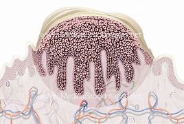 Image result for Wart Root Diagram