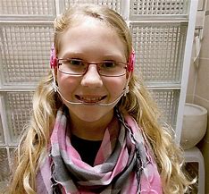 Image result for Beautiful Braces Headgear