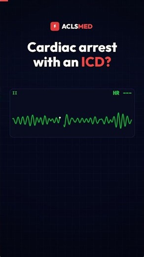 Cardiac Arrest With an ICD or Pacemaker: What Changes? #shorts