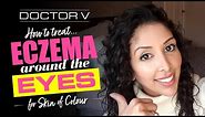Doctor V - How To Treat Eczema around the Eyes for Skin of Colour | Black or Brown Skin